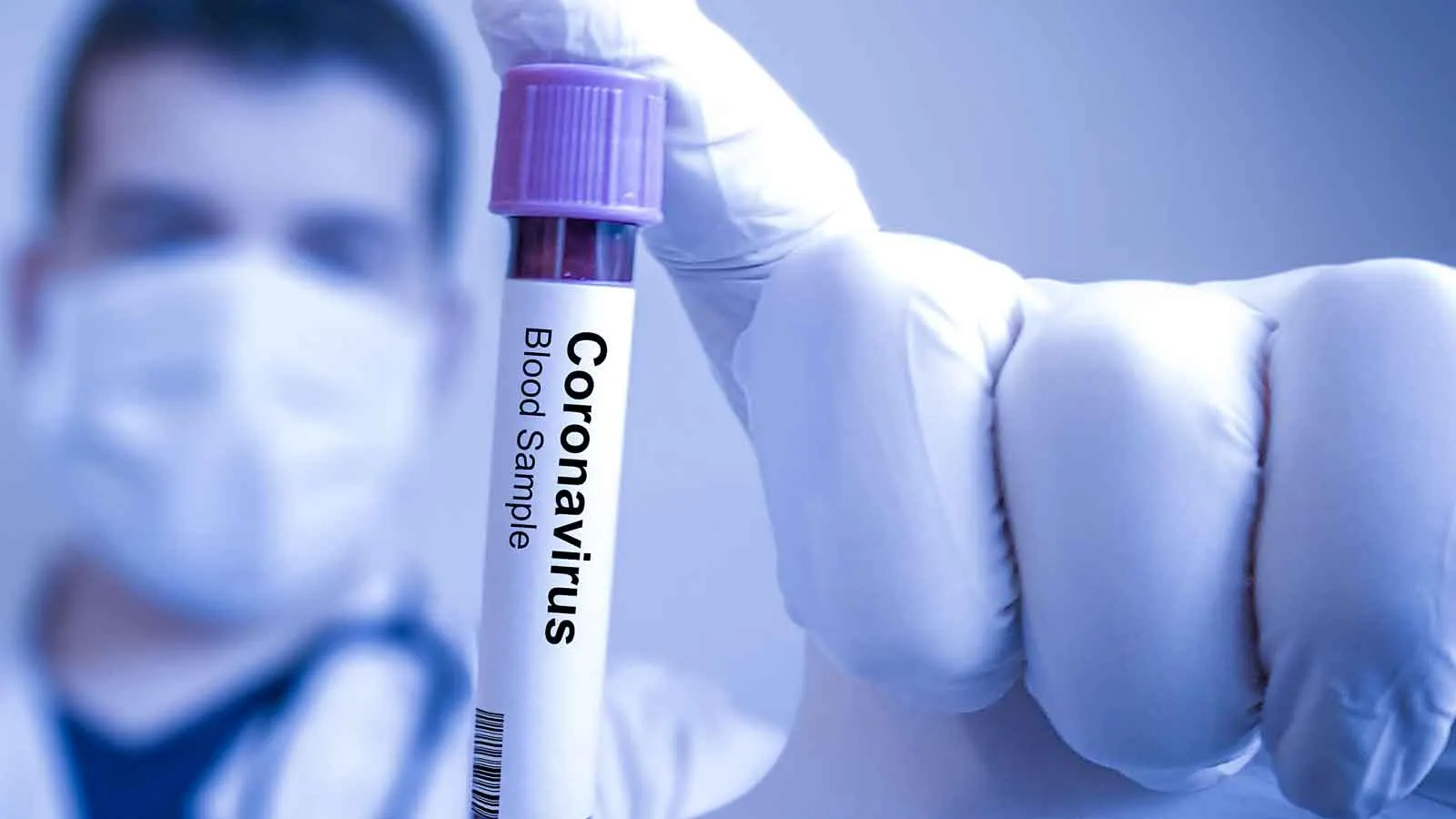 eprubeta_coronavirus